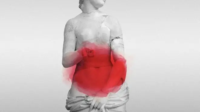 पीरियड्स, एंडोमेट्रियोसिस, महिलाएं, हेल्थ