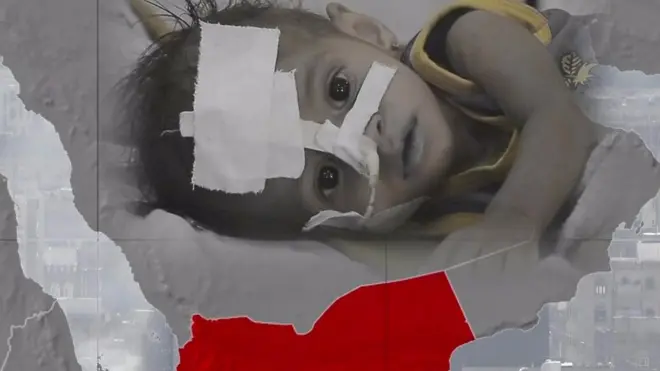 ዘይዛሪ ቅልውላው የመን