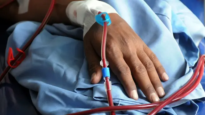 የኩላሊት እጥበት ሲካሄድ