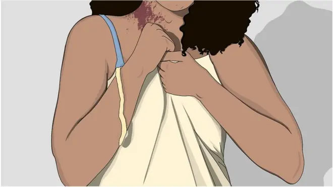 Dessin représentant une femme victime d'agression sexuelle