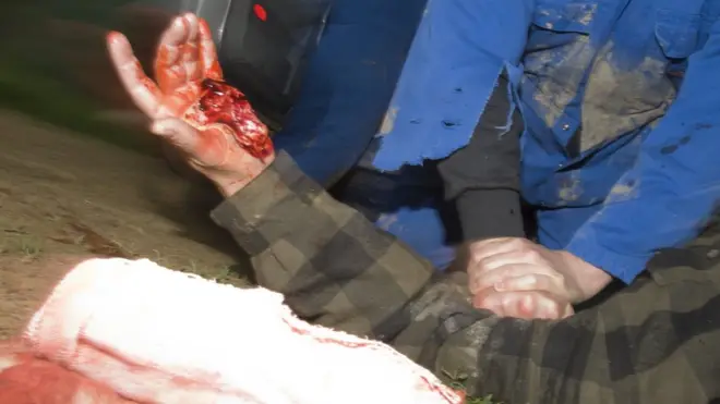 Приложение учит, в частности, останавливать кровотечение с помощью подручных средств