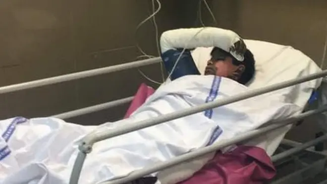 احمد پور شرقیہ سانحے میں زخمی ہونے والا ایک شخص