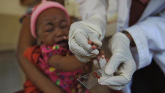 Un chercheur fait un prélèvement de sang sur un enfant atteint de paludisme (illustration)