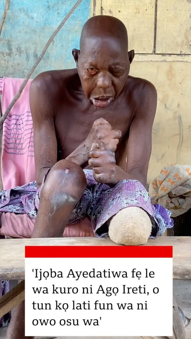 Ọkan lara awọn eeyan Ago Ireti niluu Akure