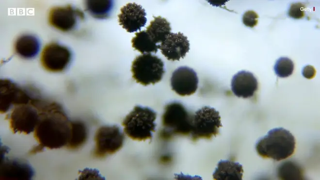 ब्लैक फंगस