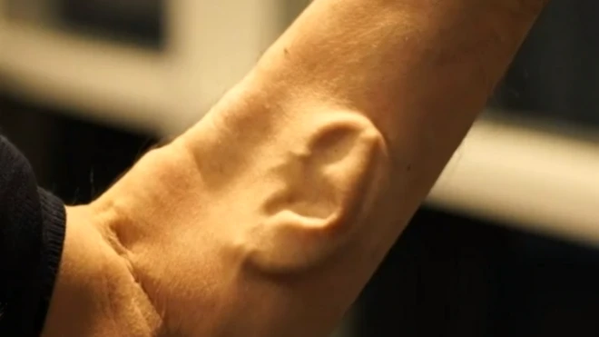 oreja en el brazo