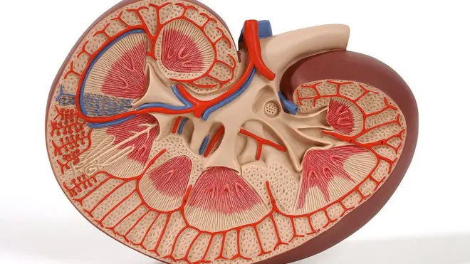 TG Omori kidney transplant: Wetin be kidney transplant and why e fit ...