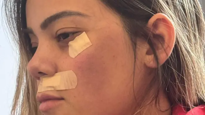 Rosto de uma mulher com curativos