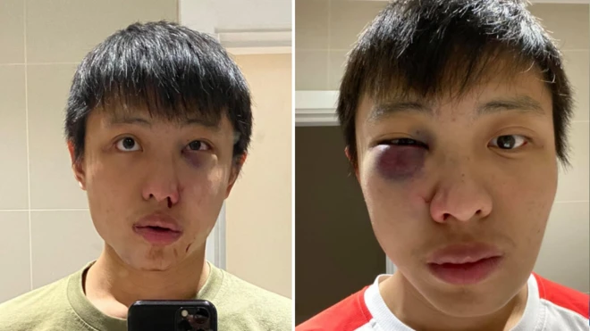 Jonathan Mok posted photos of his injuries on Facebook which have since been shared by thousands