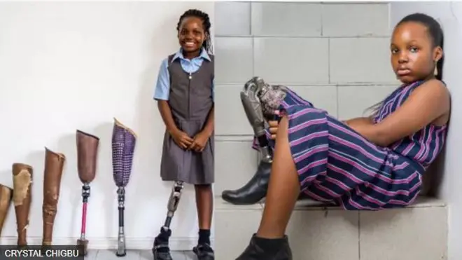 Àwòrán ọmọ tí kò ní ẹsẹ̀