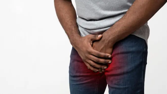 Wetin una suppose know about di problem of weak penis