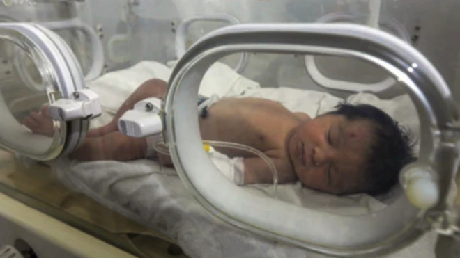 Photo of orphaned baby in hospital