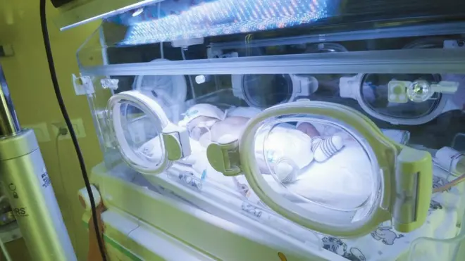 Новонароджена дитина у Рівненському перинатальному центрі, 2013 рік