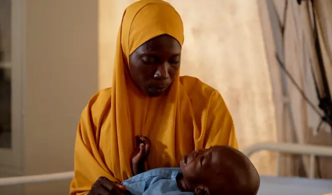 Jamila holds her son in malnutrition clinic