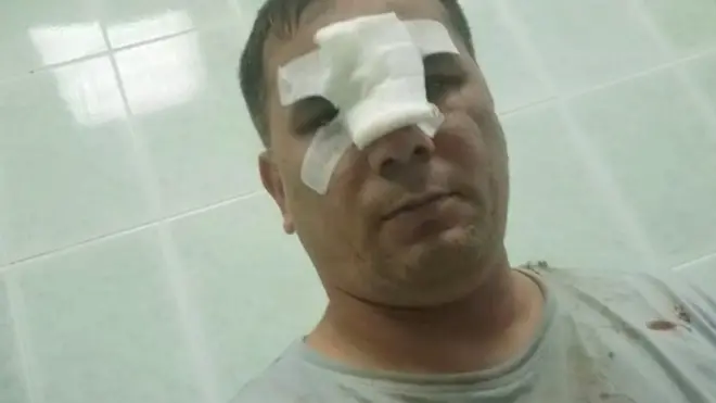 Калтакланган блогер