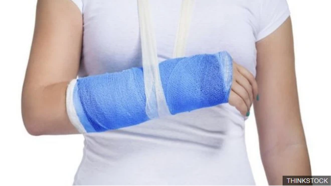 วัสดุดีที่สุดที่ใช้ประสานกระดูกหักหรือแก้ไขปัญหากระดูกอื่น ๆ ในอนาคต อาจเป็นแก้วชนิดพิเศษ