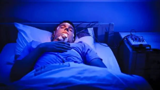 Pasien penderita sexsomania dengan peralatan elektroda untuk memantau gelombang yang ada dalam otak.