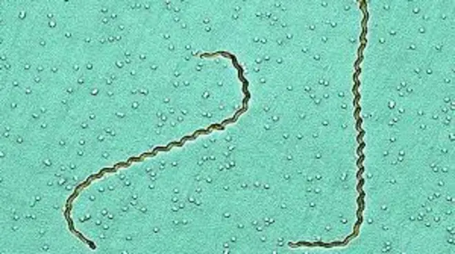 Tanzania names disease of concern as Leptospirosis