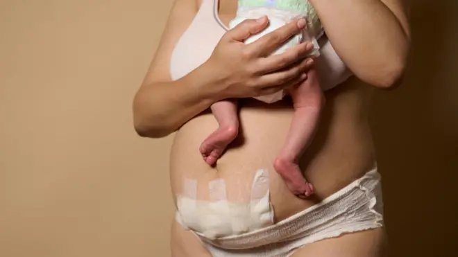 ምስ ቁስልታት ዕሸል ዝሓቖፈት ኣደ