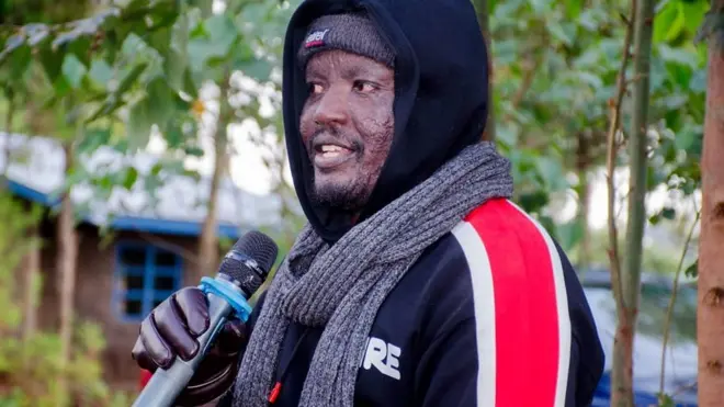 “Ni kheri umuone daktari mapema uanze matibabu ya saratani, kuliko kujificha, kwani kutakugharimu sana baadaye”