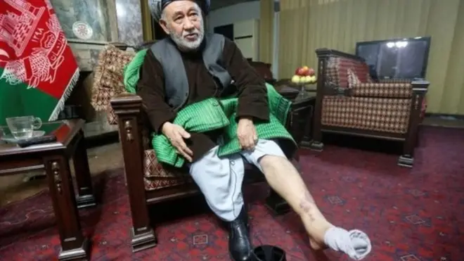 Eşçi gazetecilere bacağındaki yaraları gösterdi.