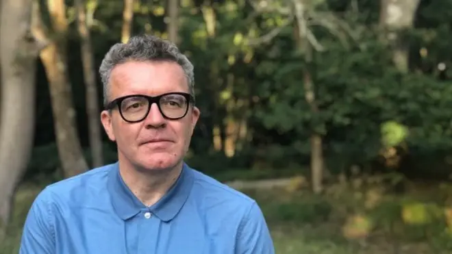 La apariciencia de Watson ha cambiado radicalmente.