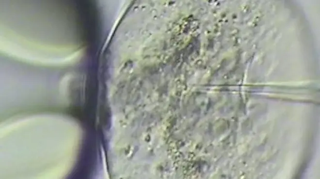 Imagen de microscopio