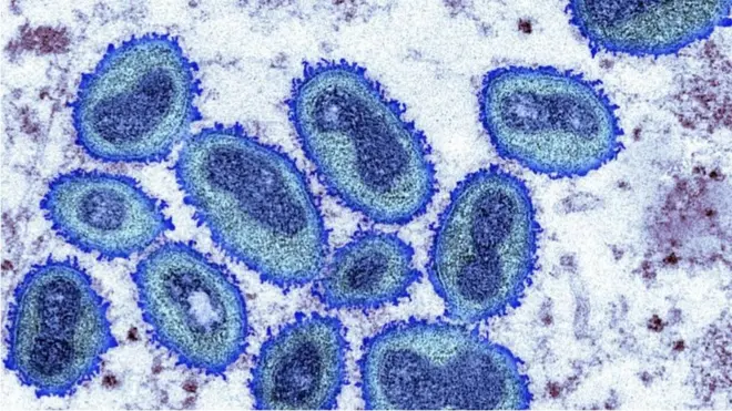 世卫组织表示，这是第一次在广泛分散的地区同时报告如此多的病例。