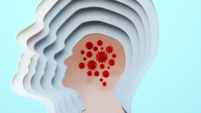 만약 미생물 감염이 알츠하이머의 원인이라면 어떻게 될까?