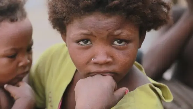 Children dey suffer for Yemen