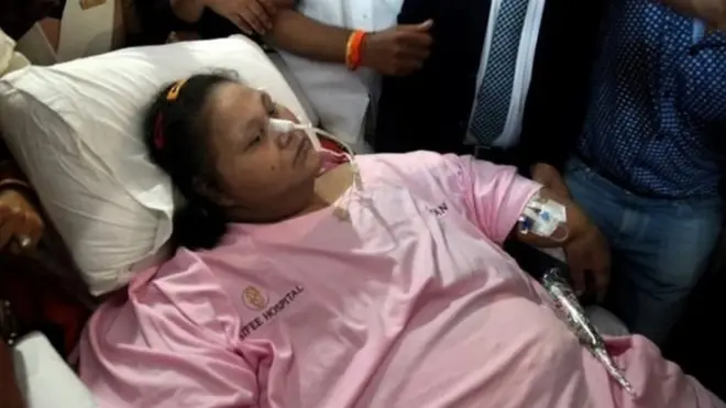 أطباء يقولون إن إيمان عبد العاطي فقدت 250 كيلوغراما