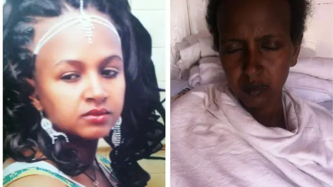 የመአዛ ካሳ የቀድሞ ፎቶና ሆስፒታል ከገባች በኋላ የተነሳ ፎቶ