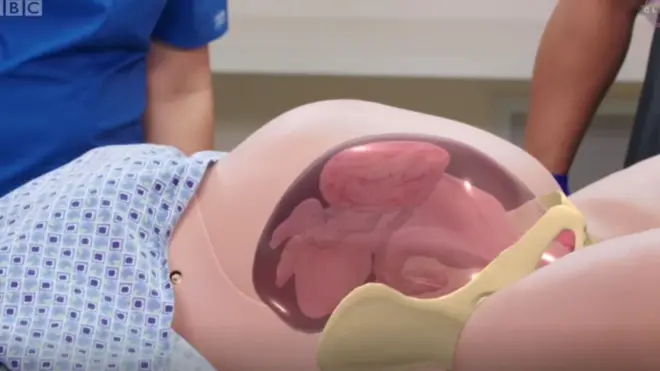 الولادة بتقنية الواقع المعزز