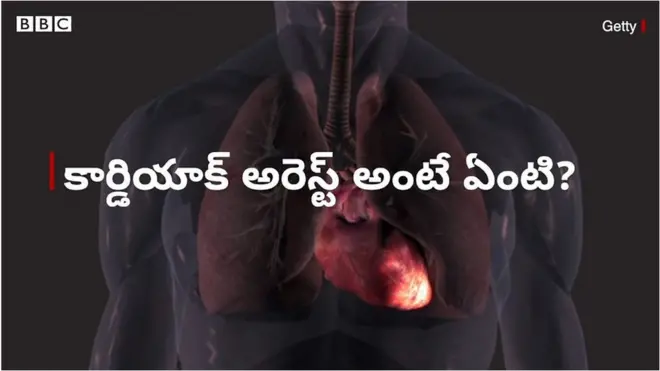 కార్డియాక్ అరెస్ట్ అంటే ఏంటి?