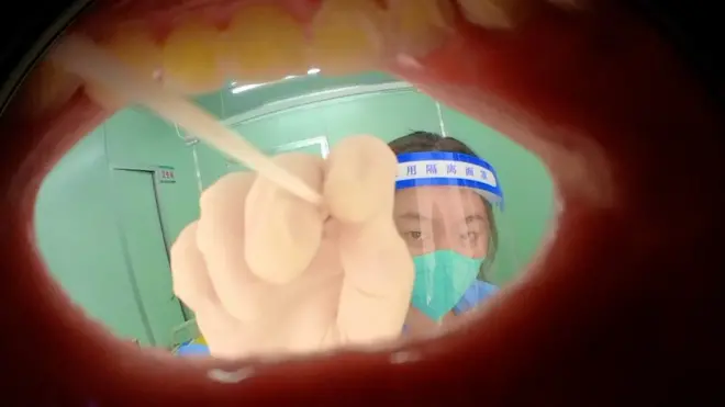 සිය මුව තුළ කෙරෙන කොවිඩ් පරීක්ෂාවක් රූගත කළ චීන කලාකරුවා