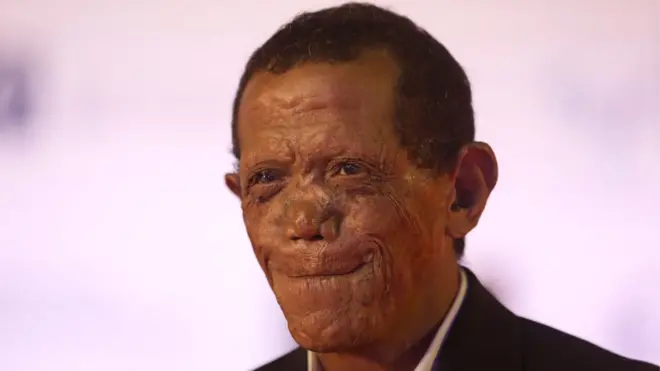 راضي جمال، الذي أدى شخصية المجذوم السابق بشاي