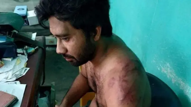 An injured Dr Senapati