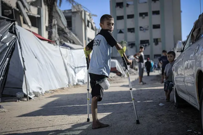 بات 21 ألف طفل على الأقل في غزة يعانون من إعاقات منذ اندلاع الحرب بين إسرائيل وحماس وفقا للأمم المتحدة.