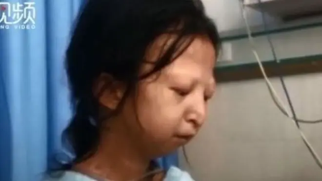 24 برس کی ہوایان غذائیت کی شدید کمی کا شکار تھیں