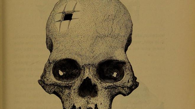 Dibujo del cráneo del libroblaze winSquier