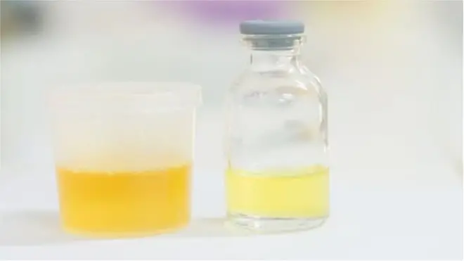 该检测方法是看尿液中食物分解后的化学成分。