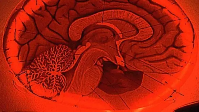 Dengan latihan, kita bisa mengendalikan apa yang terjadi di dalam otak secara sadar.