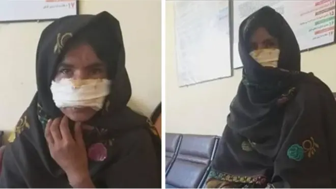 ولایتي چارواکي وایي چې دې ښخې غوښتل له خپل مېړه طلاق واخلي، او له همدې کبله یې مېړه پوزه ور پرې کړې ده