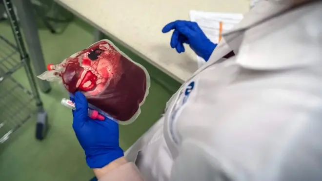 제대혈을 손에 들고 있는 사람