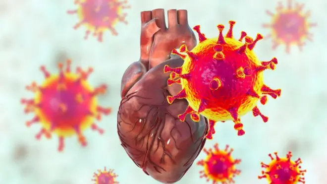 గుండెపోటు