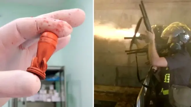 При разгоне протестующих в Тбилиси полиция использовала резиновые пули.