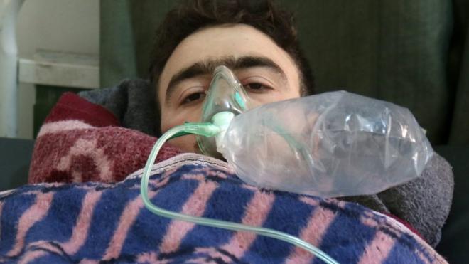 A man wearing an oxygen mask in a hospital bed in Syria