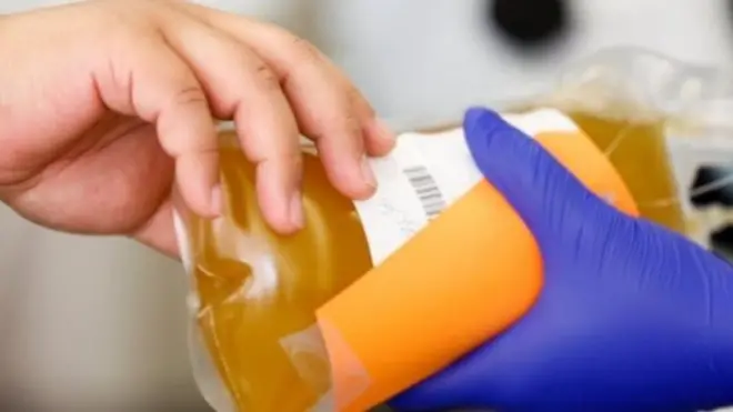 प्लाज़्मा