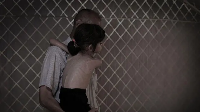 गाझाचे लोक उपासमारीच्या उंबरठ्यावर; उपासमारीचा शरीरावर काय परिणाम होतो?