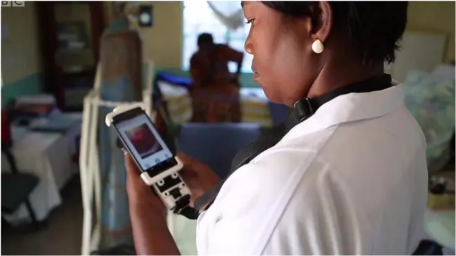 Medicinska sestra proučava snimak grlića materice